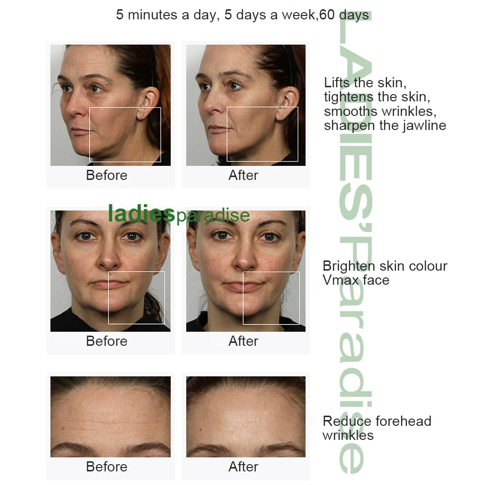 Galvanic Microcurrent Facial Firming Iontophoresis Anti-aging Wrinkle Removal Electroporator Machine for Beauty Care Massager - Image 6