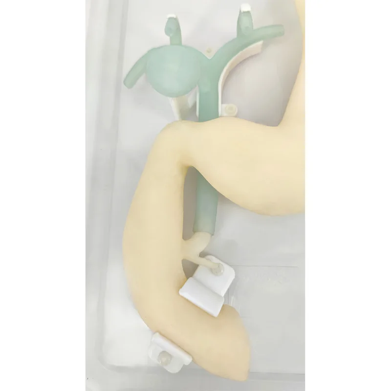 Gastroscope ERCP Scope Training Model, Gastroduodenal Simulation for Gastroscopic Surgery, Biliary System Digestion Practice with Realistic Esophagus, Stomach, Duodenum, and Tumor Simulation - Image 2