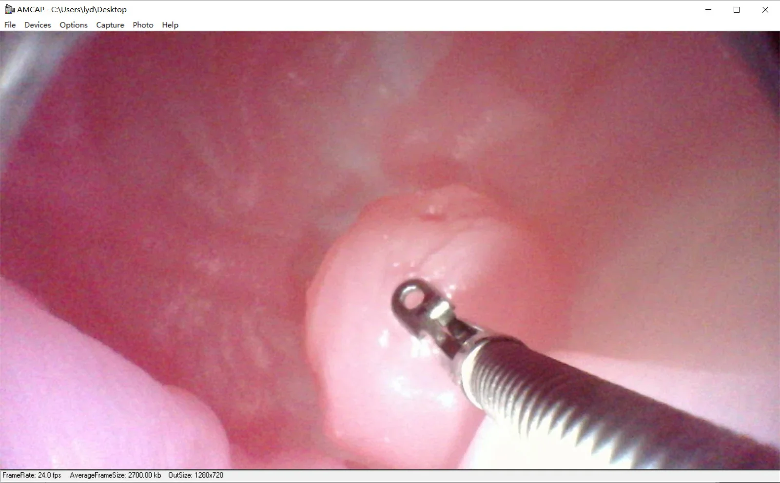 Gastroscopic surgery training model High simulation simulated stomach model ercp Gastroscope training - Image 5