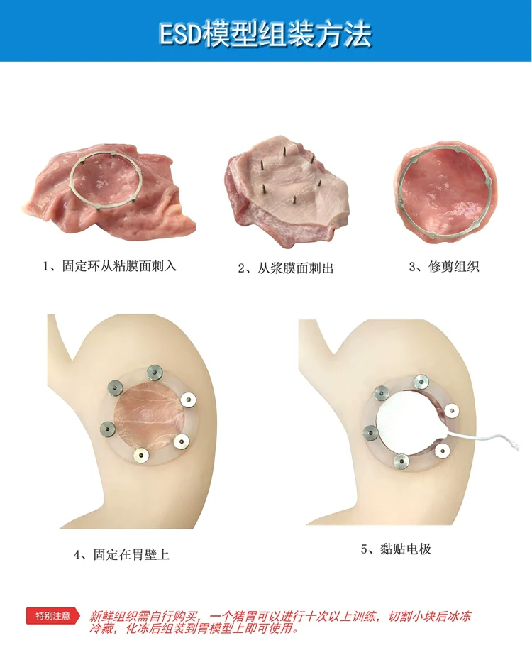 Gastroscopy training ESD surgical model endoscopic submucosal dissection model - Image 4