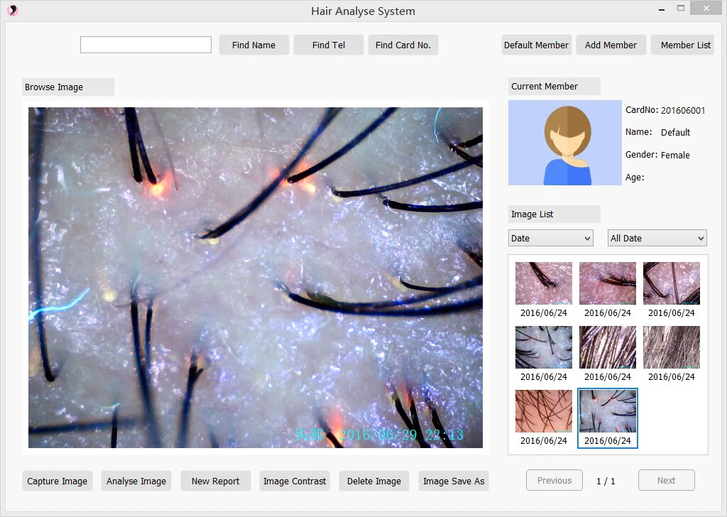 Hair Follicle Detection Hair Analyzer With Member Management Storage - Image 3