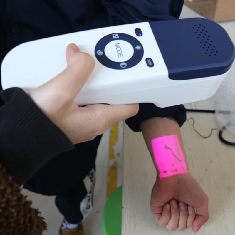Handheld Medical Adult Children Vein Finder Scanner Portable Blood Vessel Scanning For Clinic or Hospital - Image 4