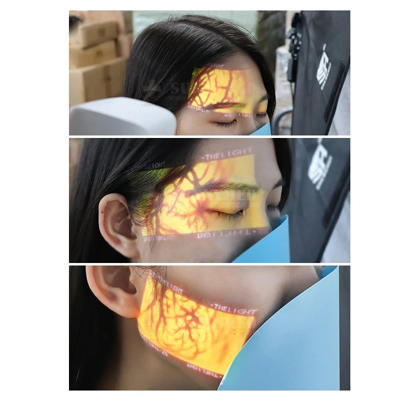 Handheld Vein Imaging Device Vein Finder Can Be Used For Cosmetic Surgery Hospitals - Image 2