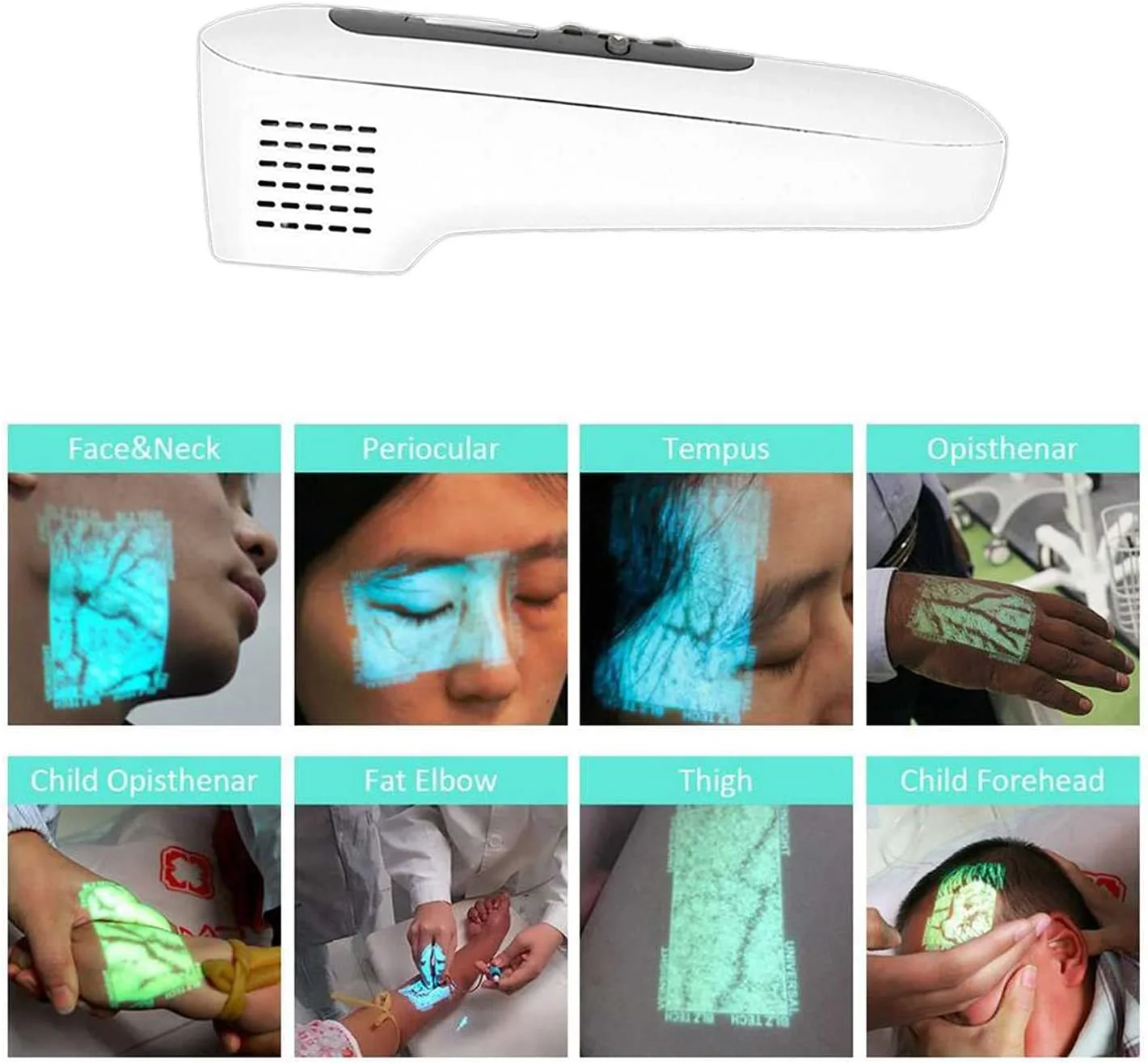 Handheld Vein Imaging Device Vein Finder Can Be Used For Cosmetic Surgery Hospitals - Image 3