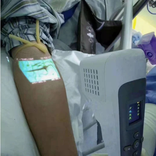 Handheld Vein Imaging Device Vein Finder Can Be Used For Cosmetic Surgery Hospitals - Image 8