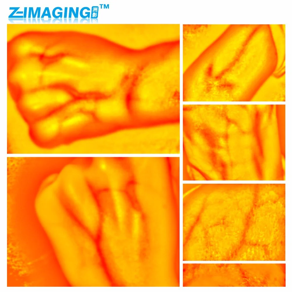 HD Vein imaging Vein Viewer Vein Finder Vein Camera Auxiliary Positioning Vein Tool - Image 2