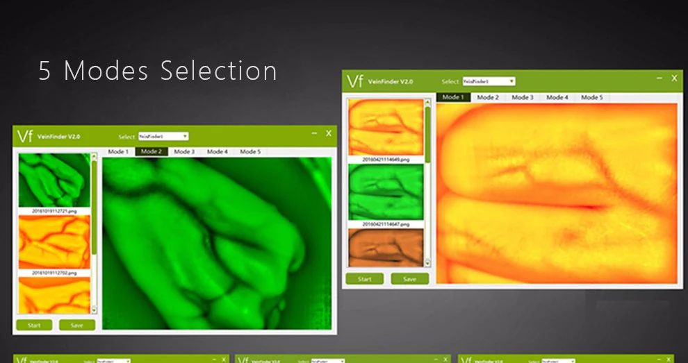 HD Vein imaging Vein Viewer Vein Finder Vein Camera Auxiliary Positioning Vein Tool - Image 5
