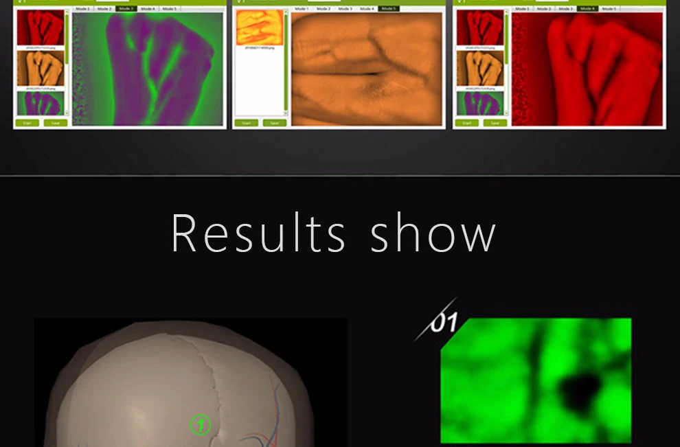 HD Vein imaging Vein Viewer Vein Finder Vein Camera Auxiliary Positioning Vein Tool - Image 6