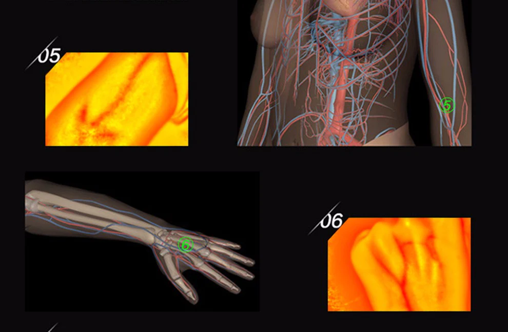 HD Vein imaging Vein Viewer Vein Finder Vein Camera Auxiliary Positioning Vein Tool - Image 8