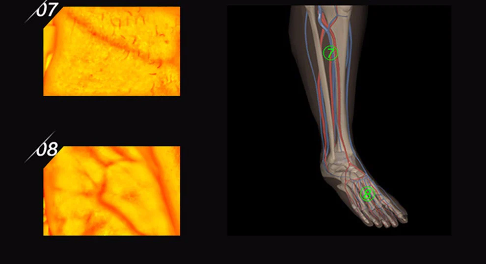 HD Vein imaging Vein Viewer Vein Finder Vein Camera Auxiliary Positioning Vein Tool - Image 9