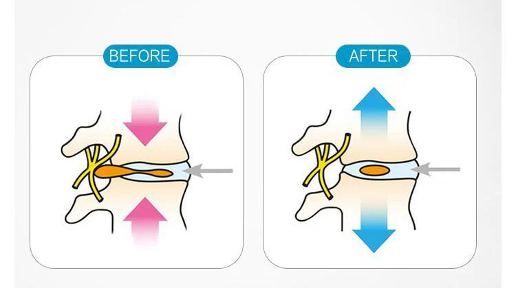 High quality Portable Pneumatic cervical vertebra tractor home health care toolNeck posture pump Neck spine traction - Image 6