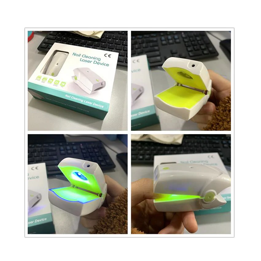 Highly Effective Rechargeable Nail Fungus Laser Device Nail Infection Onychomycosis Cure Nail Fungal Infections - Image 3