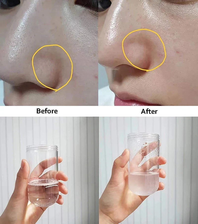Home Use Vacuum Blackhead Small Bubble Exfoliator Cleansing Moisturizing Oxygen Injection Instrument Aqua Peeling Beauty Machine - Image 6