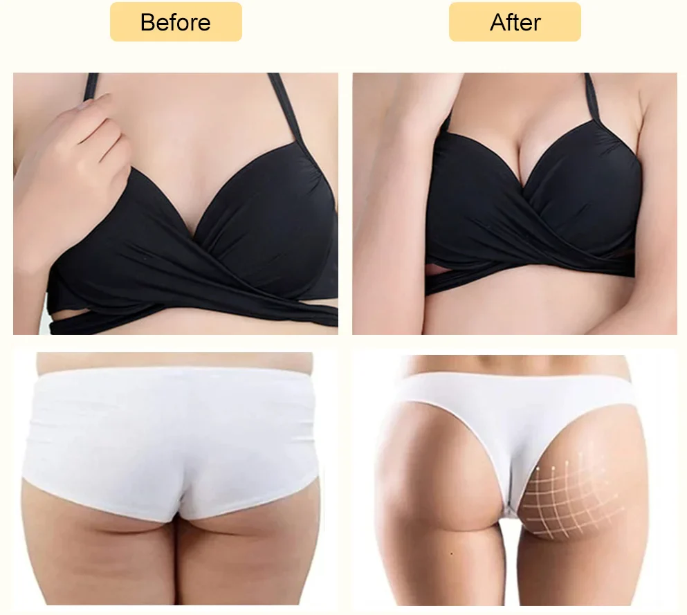 Hot Sale ! Vacuum Therapy Machine Buttock Lifting Butt Enhancer Breast Enlargement Vacuum Butt Lifting Machine/ Vacuum Pump - Image 6