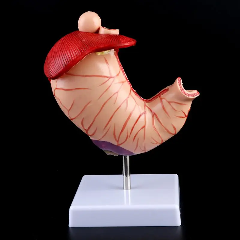 Human Anatomical Anatomy Stomach Medical Model Gastric Pathology Gastritis Ulcer Medical Teaching Learning Tool - Image 2