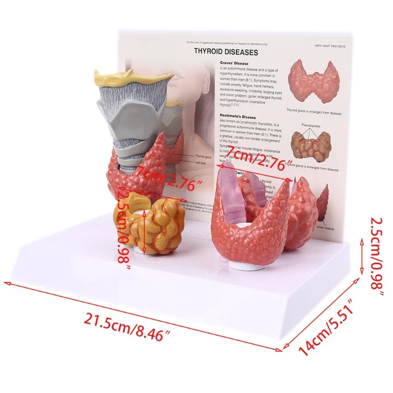Human Anatomical Thyroid Gland Model Pathology Anatomy Digestive System Display Study Teaching Tool Halloween - Image 6