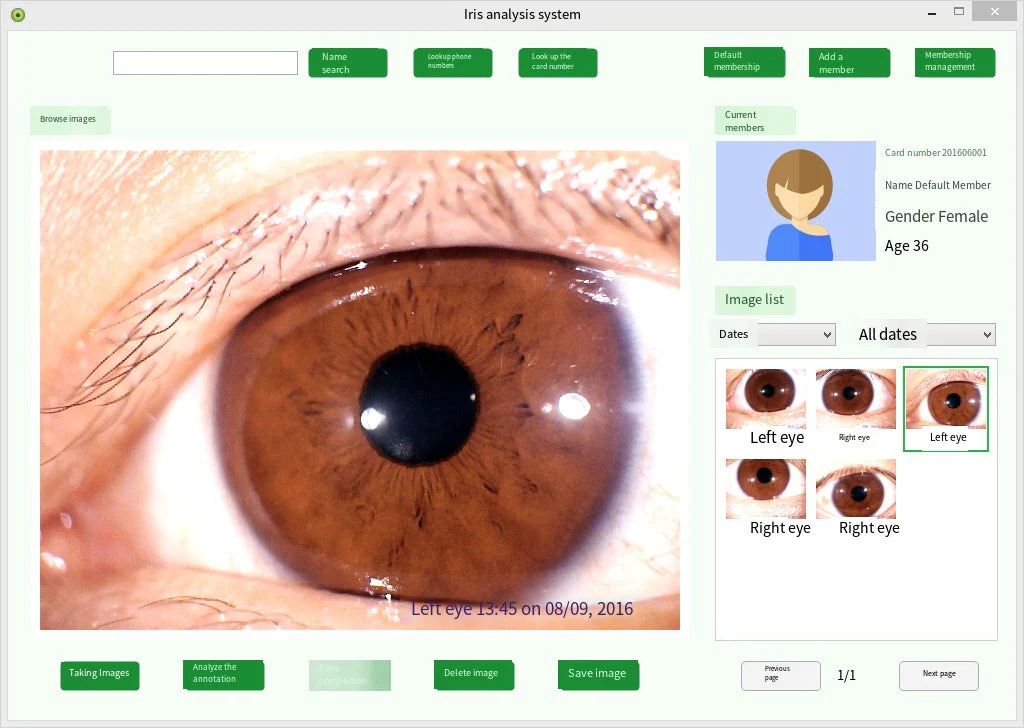 Iridology Analysis Iris Analyzer Iriscope Digital Iridology Camera - Image 5