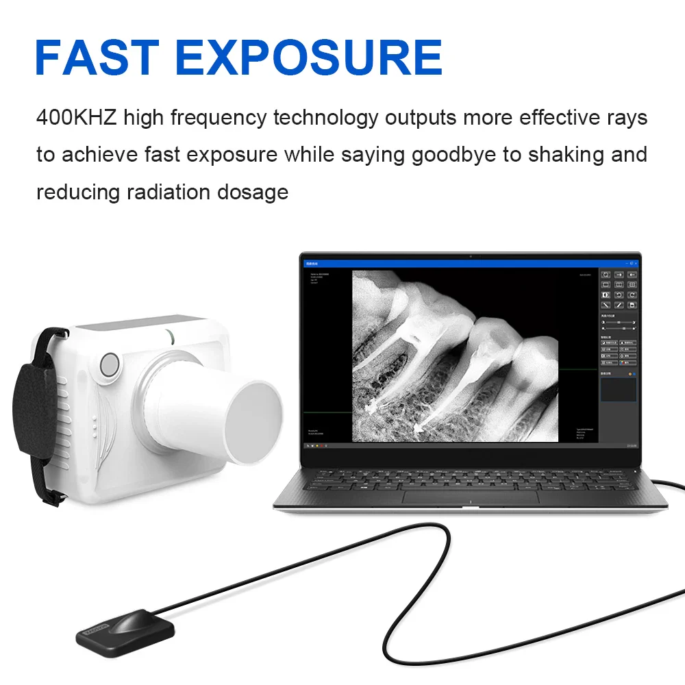 Dental X Ray Dental Imaging System Intraoral Digital X-ray Sensor Size Image Sensor for Veterinary Clinics Dental Clinic - Image 3