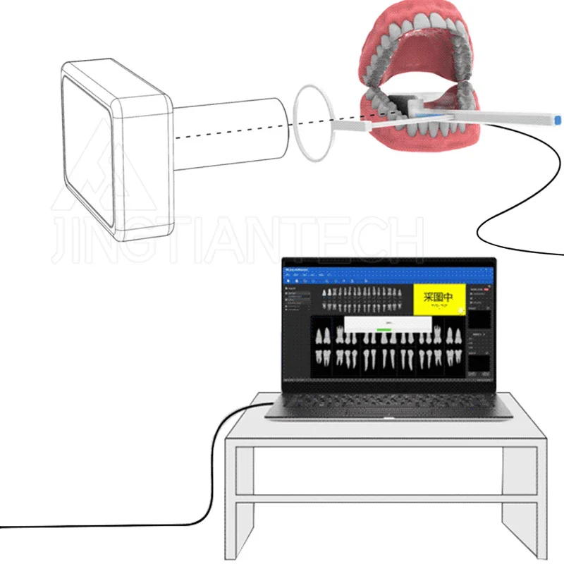 Dental X Ray Dental Imaging System Intraoral Digital X-ray Sensor Size Image Sensor for Veterinary Clinics Dental Clinic - Image 4