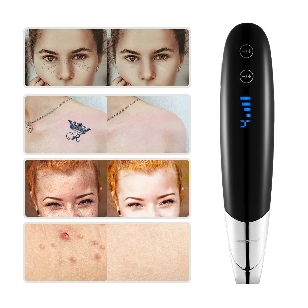Laser Picosecond Pen Freckle Tattoo Removal Aiming Target Locate Position Mole Spot Eyebrow Pigment Remover Acne Beauty Tool - Image 3