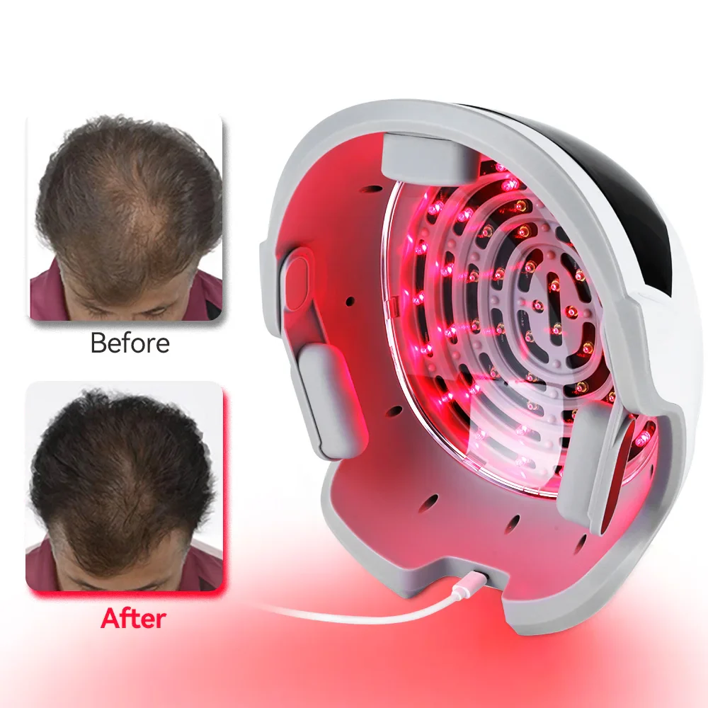 Lescolton D610 Hair Growth Device Laser Hair Growth Helmet Laser Red Light Cap Hair Loss Treatment Hat for Mens and Women Wireless - Image 6