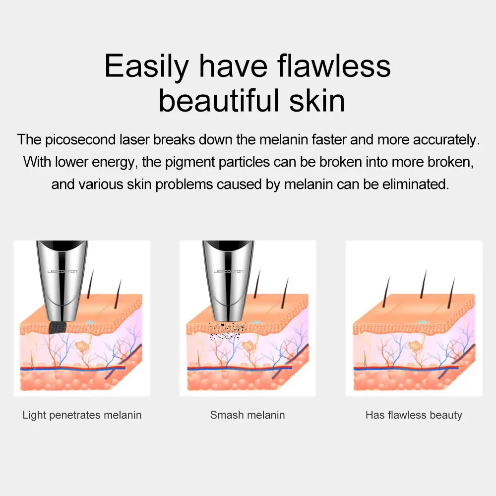 Lescolton Laser Picosecond Pen Tattoo Mole Wart Freckle Melanin Removal Machine Scars Dead Skin Remover Laser Pen Beauty Devices - Image 4