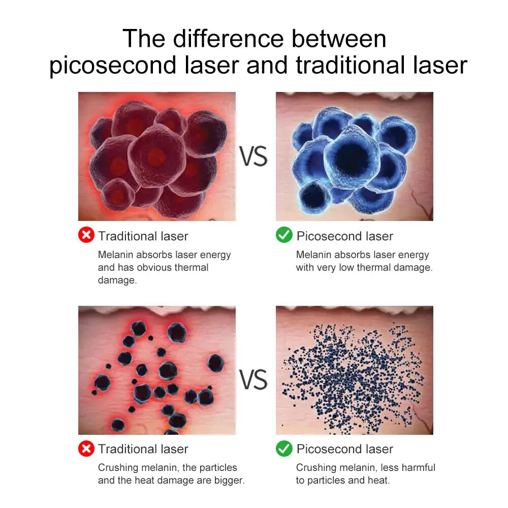 Lescolton Laser Picosecond Pen Tattoo Mole Wart Freckle Melanin Removal Machine Scars Dead Skin Remover Laser Pen Beauty Devices - Image 5
