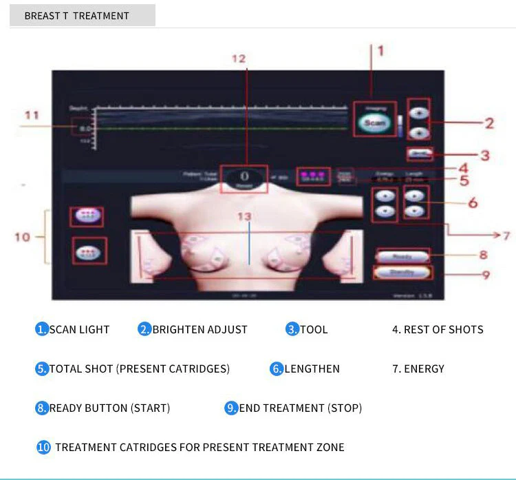 Hot Liposonix Hifu Machine Body Slimming Cellulite Massager Liposonic Fat Removal Weight Loss Body Shaping Beauty Equipment - Image 9