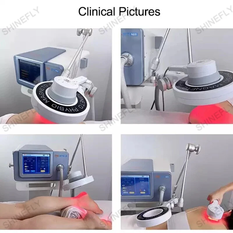 Magnetoterapia Fisioterapia With Near Infrared Magneto Therapy Machine Non Invasive Ambulant No Reported Side Effects - Image 6