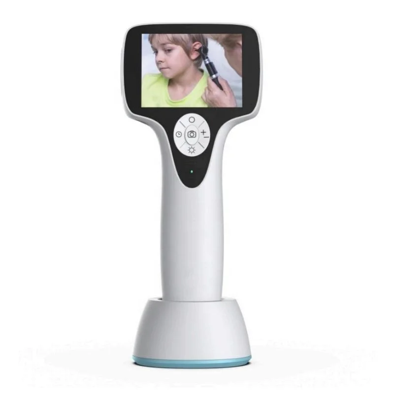 Medical Ear Scope Besdata HD Otoscope Digital Medical Otoscopio ENT endoscope - Image 4