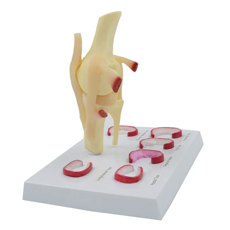 Meniscus Suture Model Life Size Human Demilune Menisci Medical Science Teaching Tool Anatomical Model - Image 2