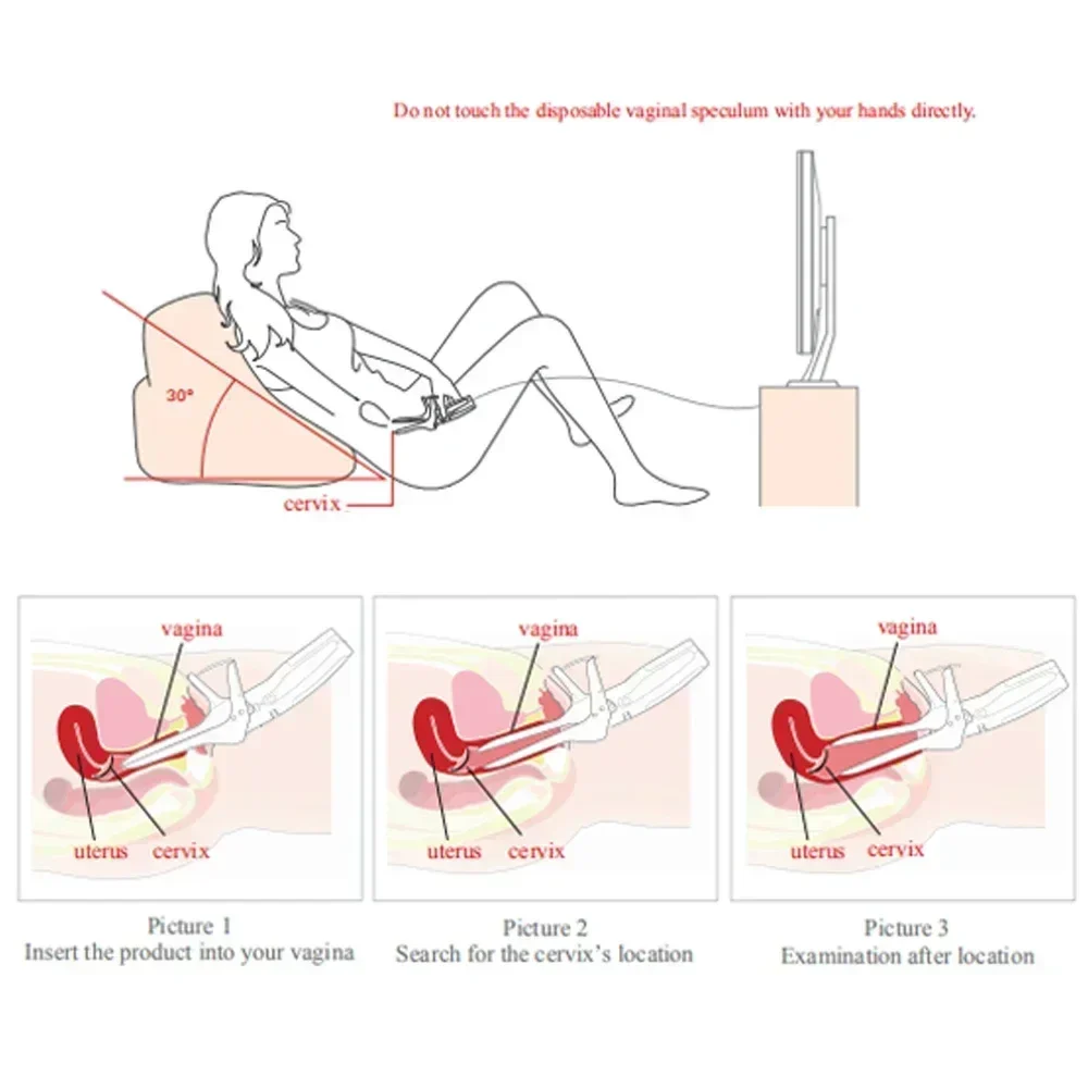 Mini Colposcope with Digital Video for Accurate and Convenient Health Monitoring Optional Monitors Self-testing Accessories - Image 3