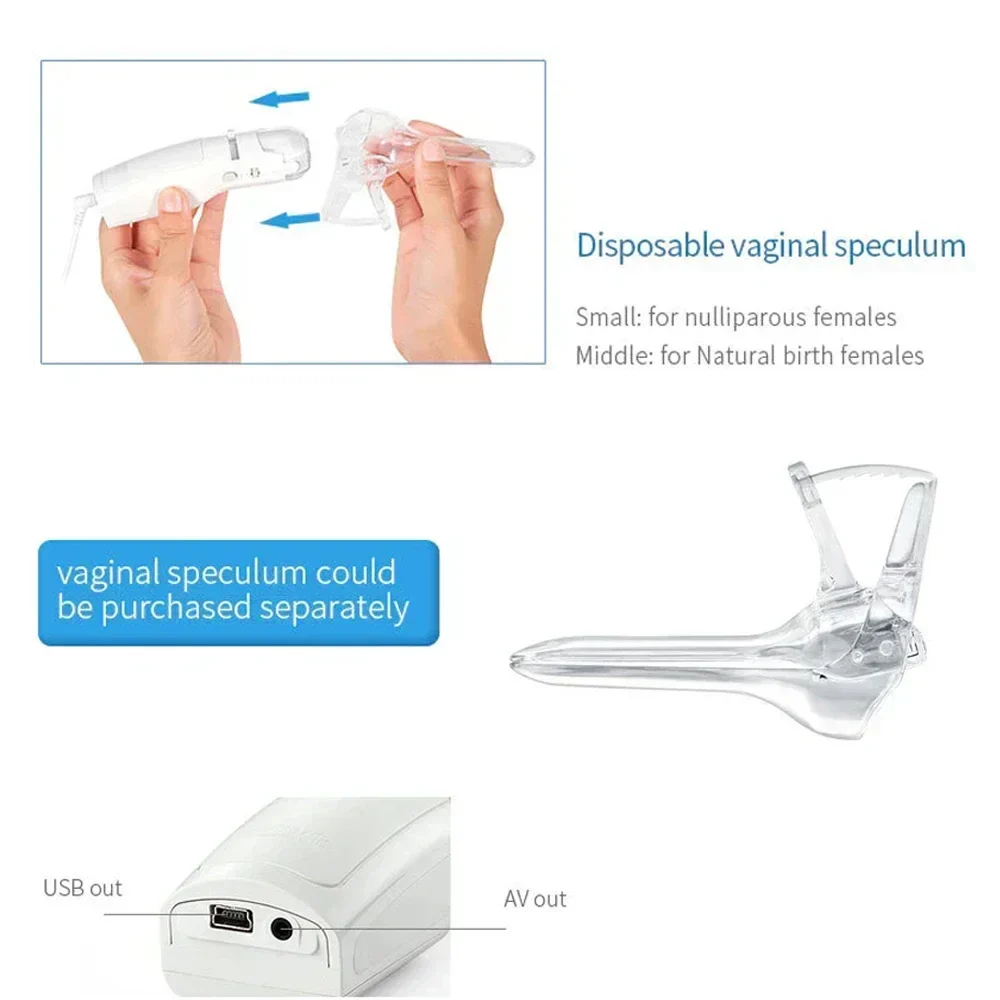 Mini Colposcope with Digital Video for Accurate and Convenient Health Monitoring Optional Monitors Self-testing Accessories - Image 4