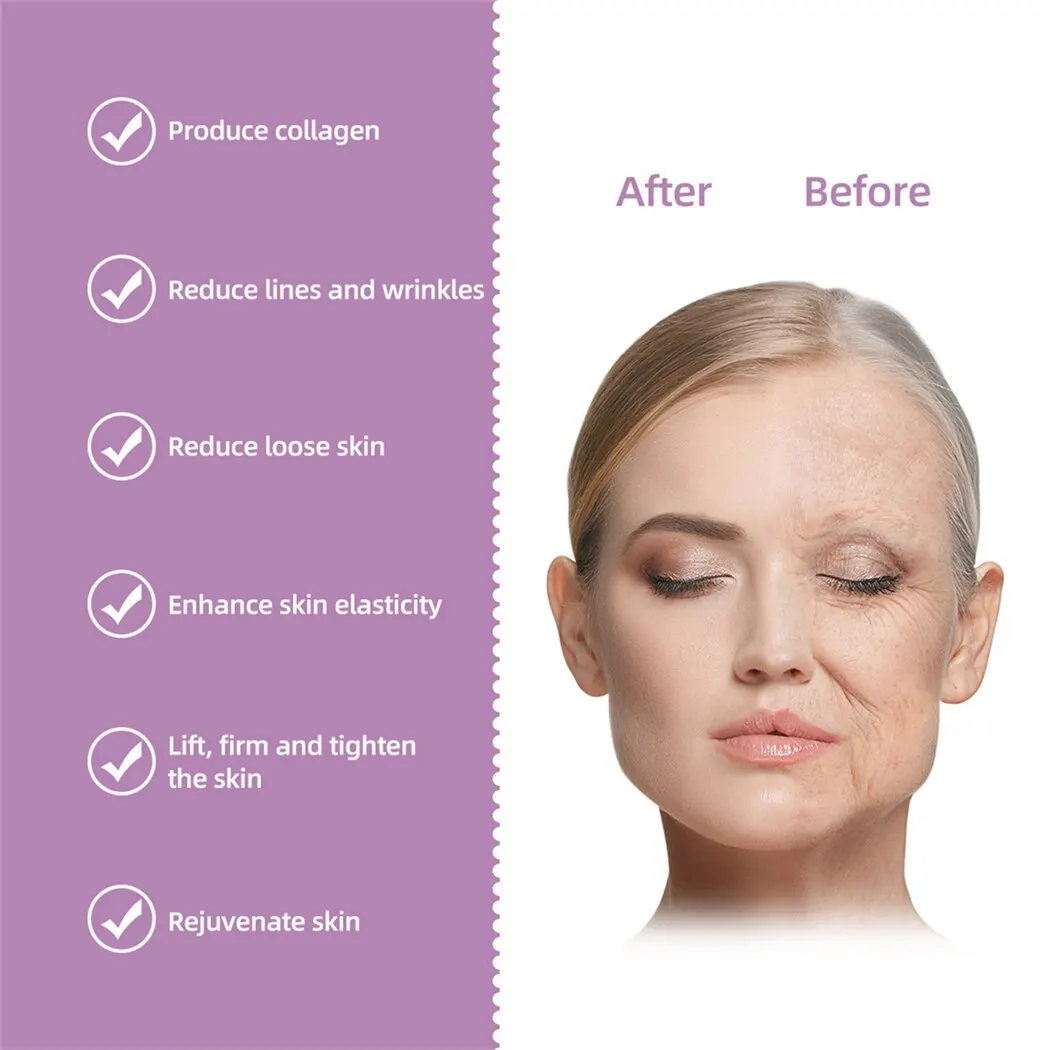 Mini HIFU Ultrasound Vibration Face Skin Tightening Machine Portable RF Face Lifting Device Anti-aging Facial Toning Device - Image 7