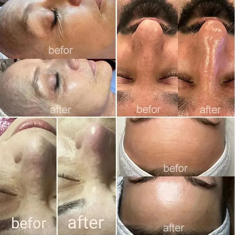Moisturizing Facial Skin Care Diamond Skin Machine Spray Moisturizing Cleaning Anti-aging Facial Skin Machine - Image 7