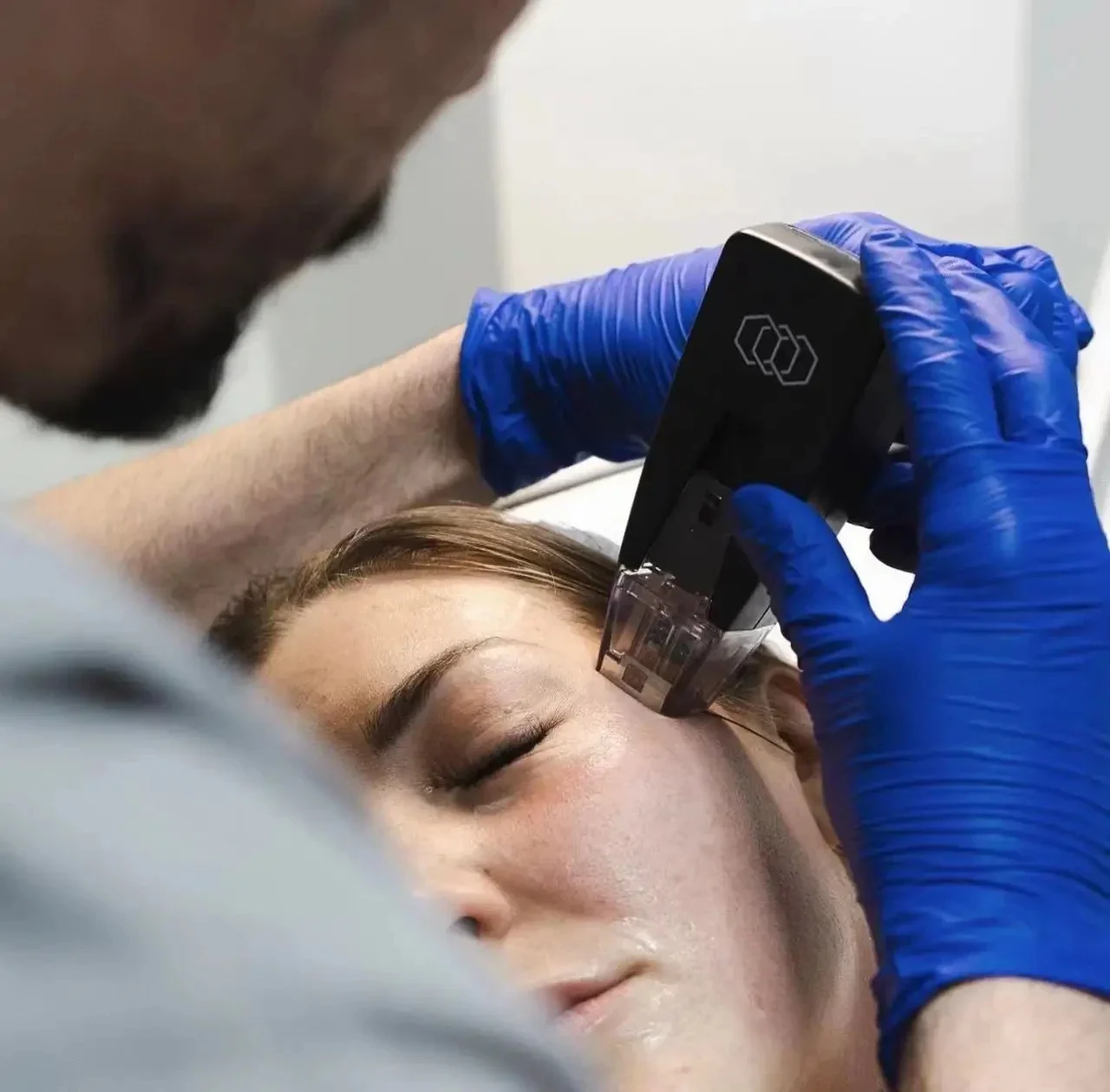 Morpheus8 Machine Fractional RF Microneedling Machine Inmode - Image 2