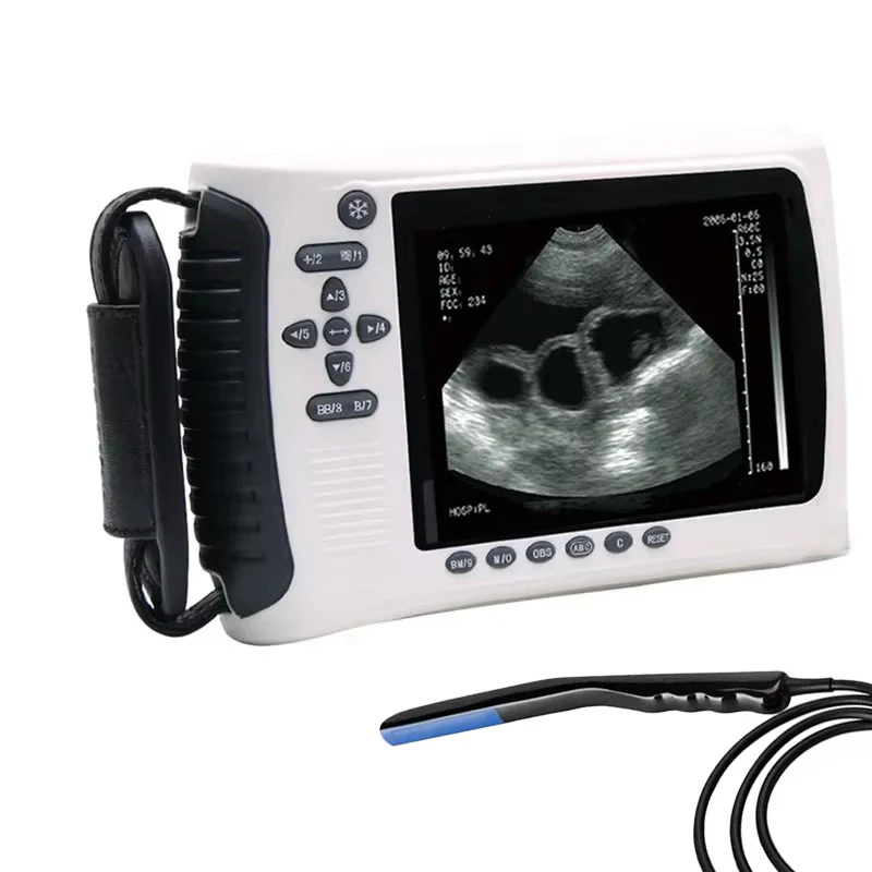 MSLVU22 Medical Vet Ultrasound Machine Portable Ultrasound Scanner Digital Veterinary Ultrasound Scanner - Image 10