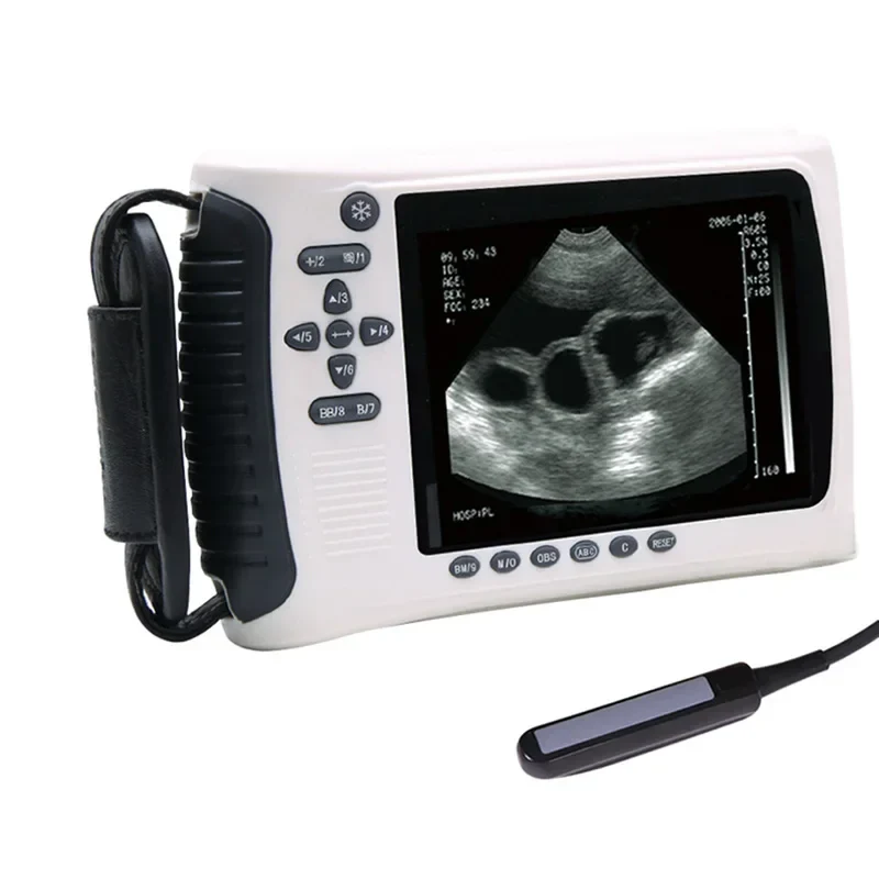 MSLVU22 Medical Vet Ultrasound Machine Portable Ultrasound Scanner Digital Veterinary Ultrasound Scanner - Image 2