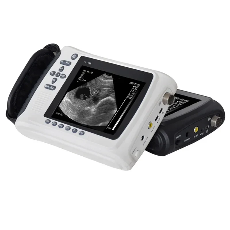 MSLVU22 Medical Vet Ultrasound Machine Portable Ultrasound Scanner Digital Veterinary Ultrasound Scanner - Image 5