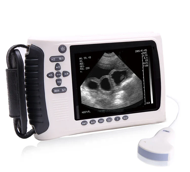 MSLVU22 Medical Vet Ultrasound Machine Portable Ultrasound Scanner Digital Veterinary Ultrasound Scanner - Image 7