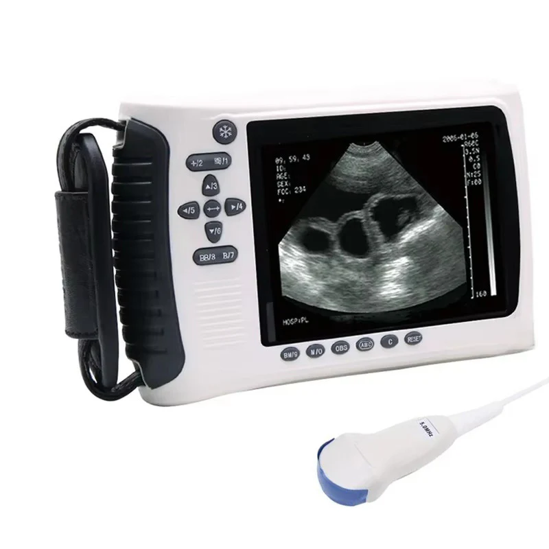 MSLVU22 Medical Vet Ultrasound Machine Portable Ultrasound Scanner Digital Veterinary Ultrasound Scanner - Image 8