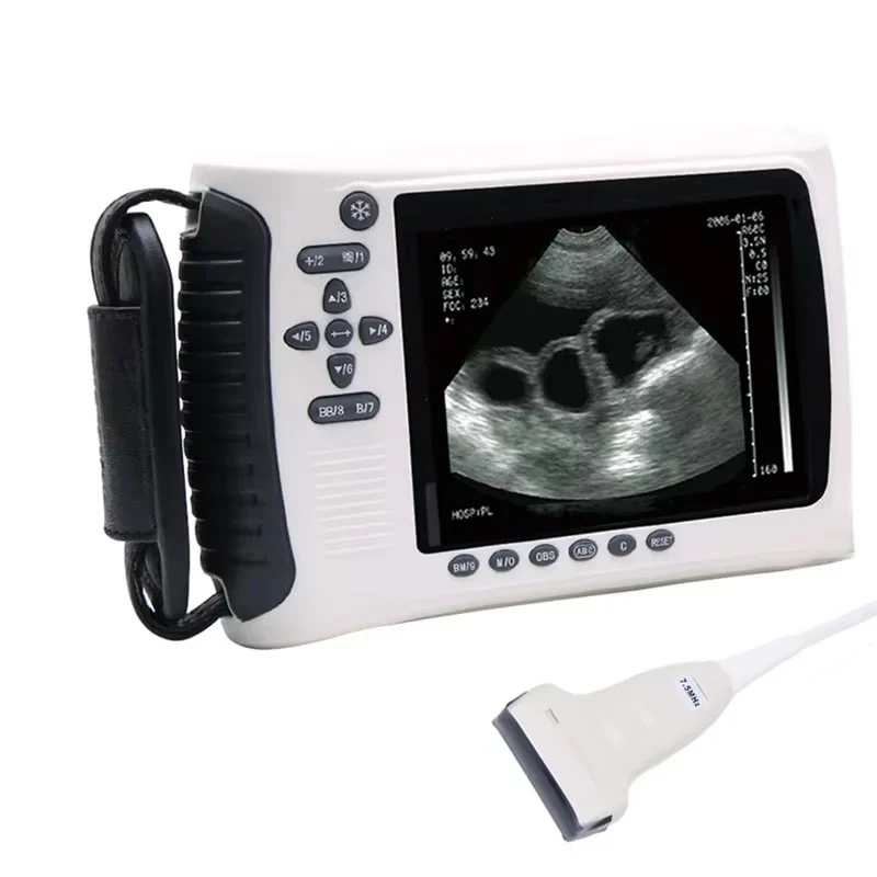 MSLVU22 Medical Vet Ultrasound Machine Portable Ultrasound Scanner Digital Veterinary Ultrasound Scanner - Image 9