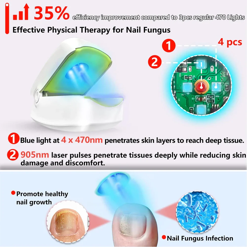 Nail Fungus Cleaning Laser Device Blue Light Nail Therapy for Damaged Discolored Thick Toenails Nail Fungus Treatments Machine - Image 3