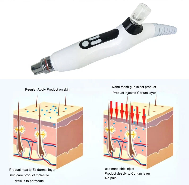 Needle Free Mesotherapy Machine 5G MNCM Micro Nano Chip Meso Gun EMS RF + MESO - Image 10