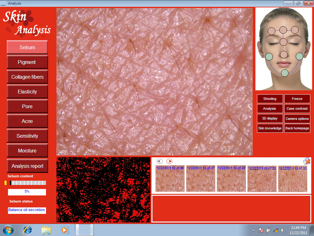EH-900U 5.0 MP HD usb 3D Skin Analysis Skin scope Diagnosis Analyzer Facial Skin Moisture Oil Acne Tester Meter Monitor - Image 5