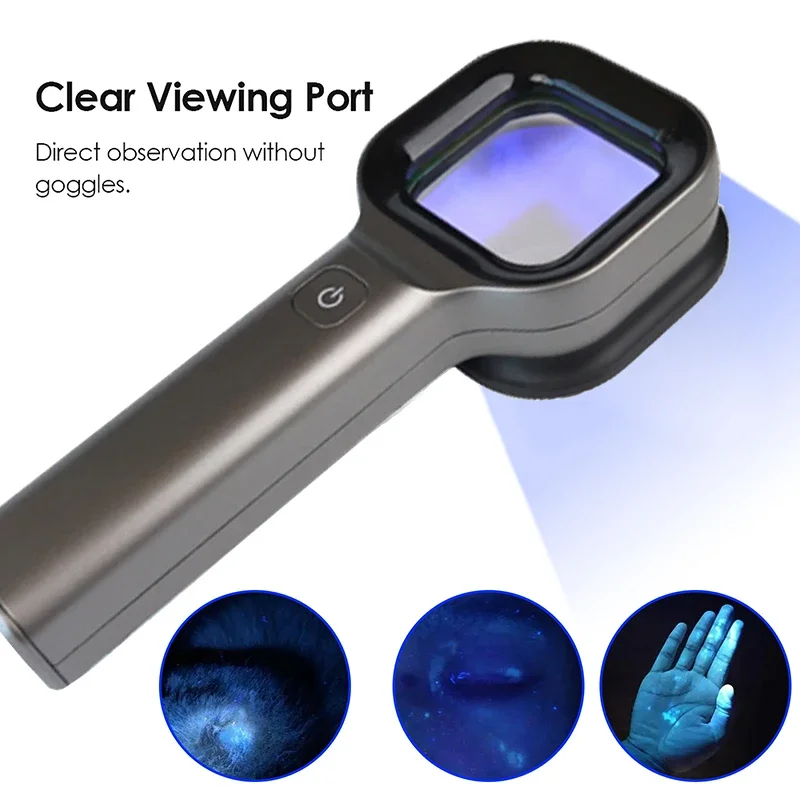 New Skin Analyzer With Woods Lamp Portable Vitiligo Detector Skin Analysis Machine Rechargeable Skin Detection Wood Light Lamp - Image 4