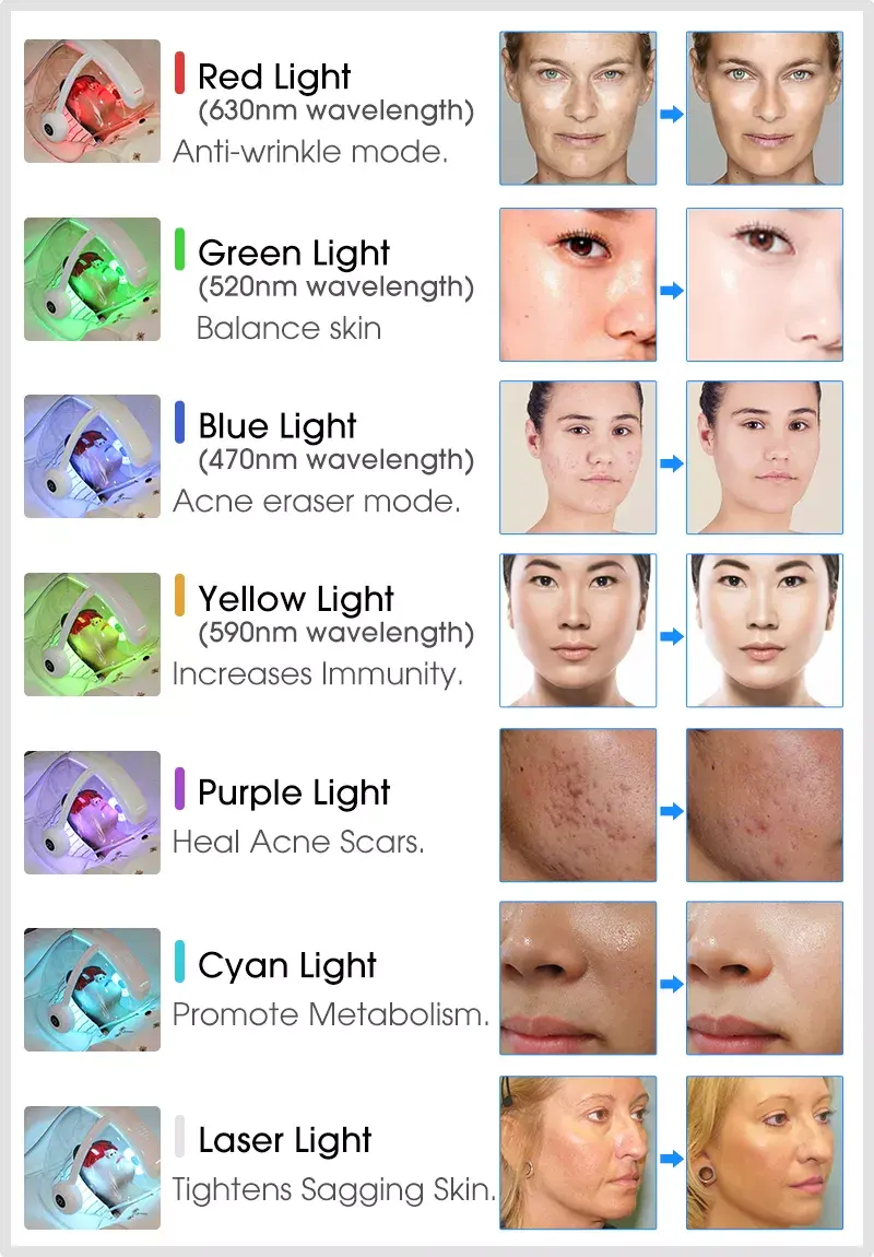 Newest O2toderm Oxygen Dome With 7 Colors LED Light Therapy Oxygen Jet Facial Beauty Machine - Image 6