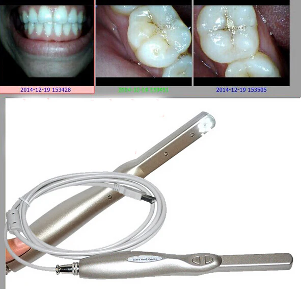 Oral Dental USB Intraoral Camera endoscope borescope 6 led light Home USB camera teeth photo shoot, Dentist Intra oral Camera - Image 3