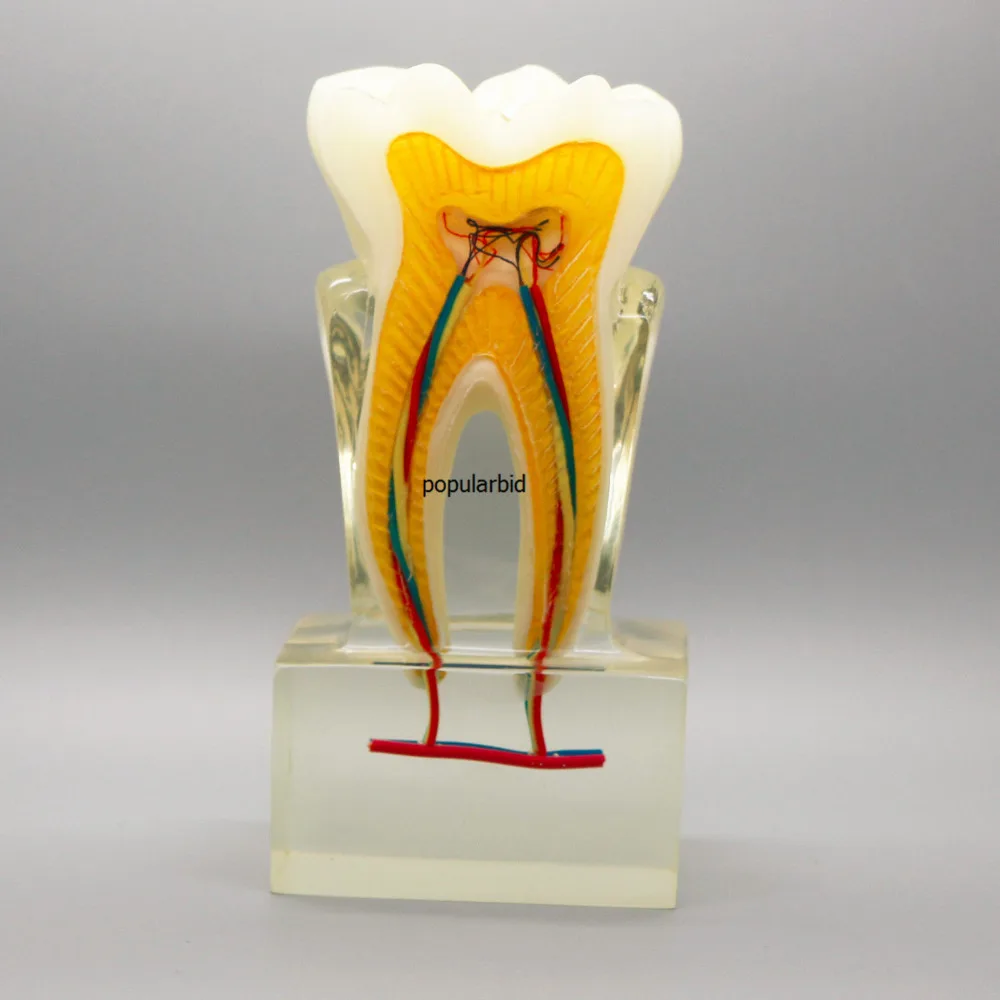 Orthodontic model 6:1 teeth Teaching with clear base nerve anatomical dissection demonstration Dentist endodontics - Image 2