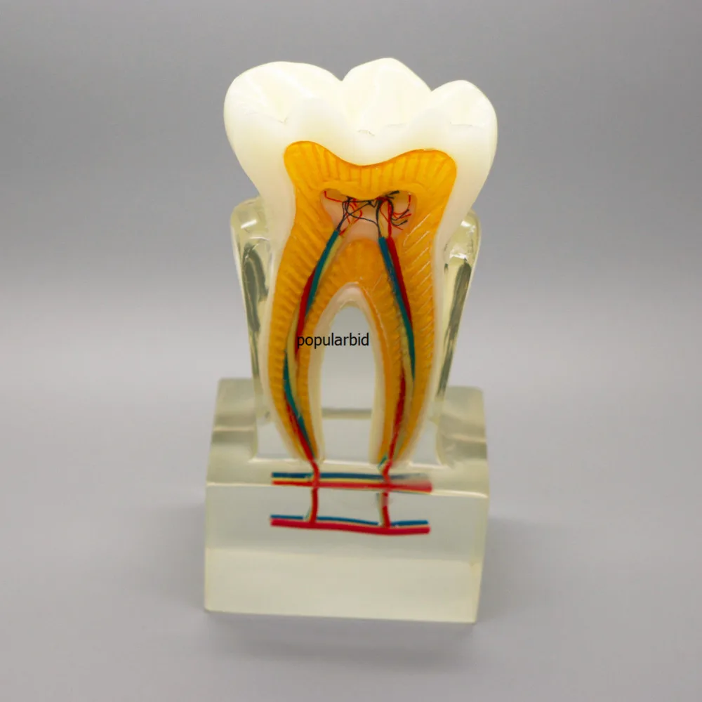 Orthodontic model 6:1 teeth Teaching with clear base nerve anatomical dissection demonstration Dentist endodontics - Image 3